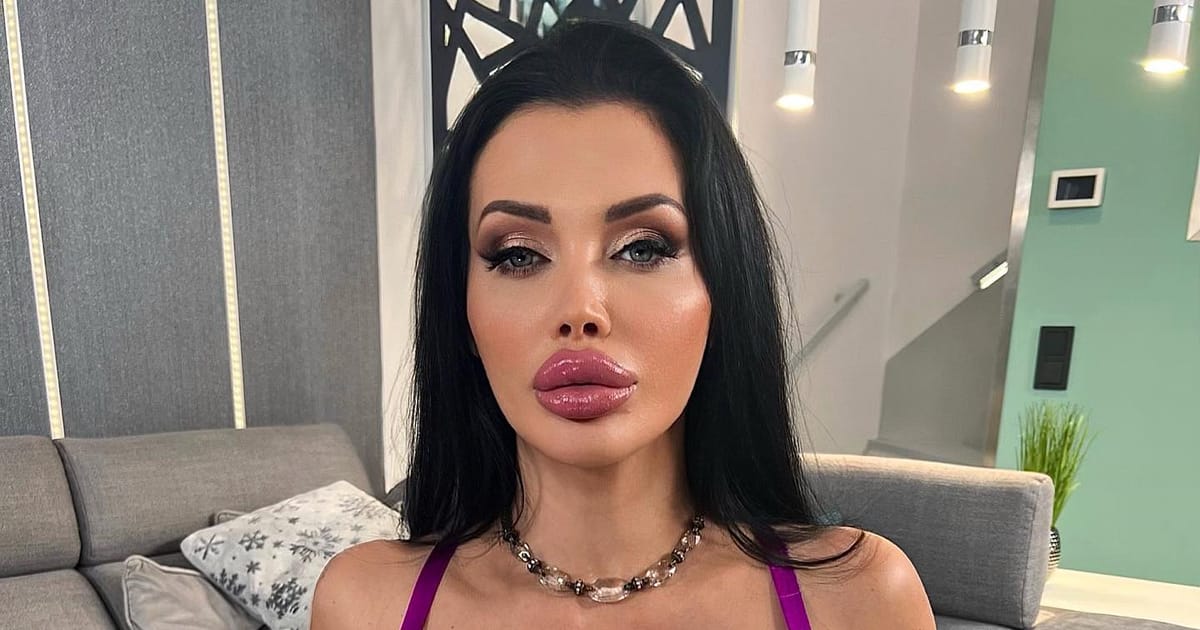 dmitriy yakovenko recommends Aletta Ocean Plastic Surgery