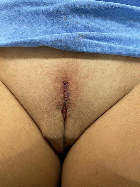 cheryl lehigh add sex with a post op transexual photo