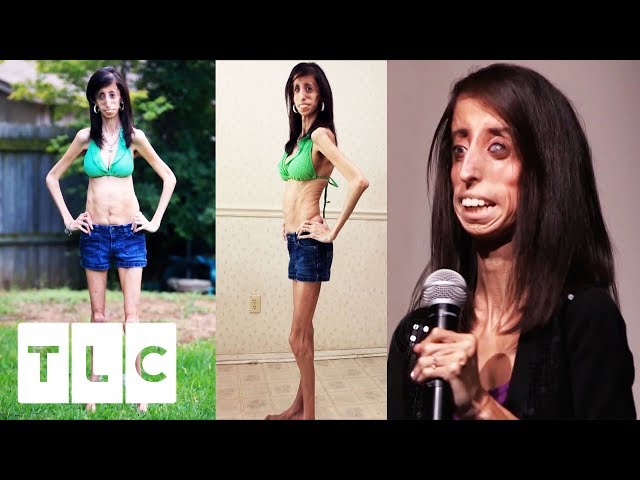 donna r holloway recommends the skinniest girl ever pic