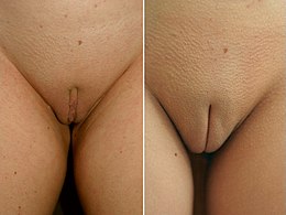 antonia nascimento add female genital mutilation porn photo