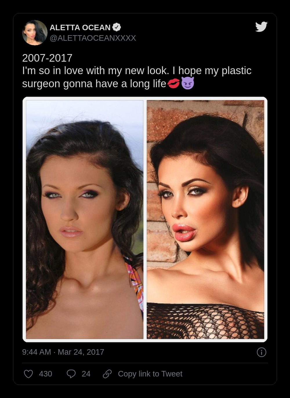 cheryl dietrich add aletta ocean plastic surgery photo