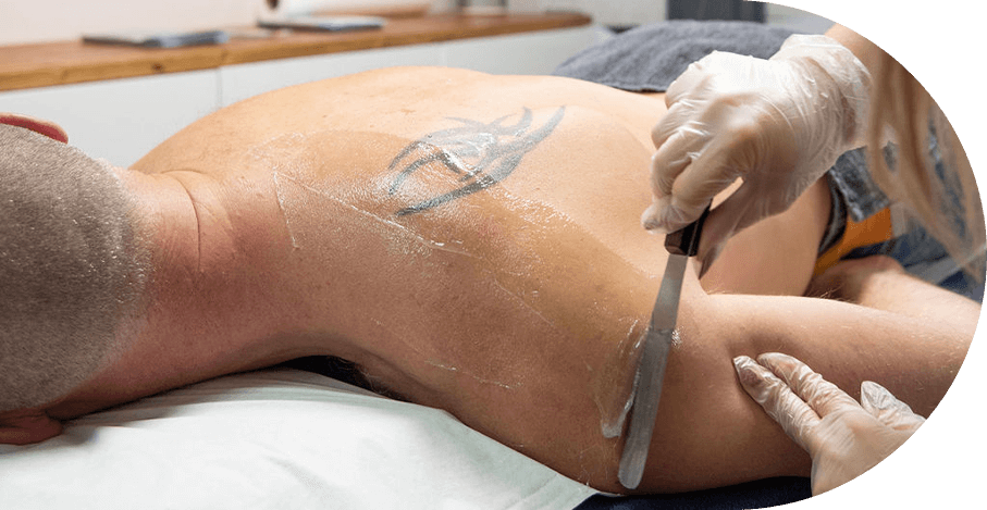 arlene oracion add brazilian wax pictures before and after male photo