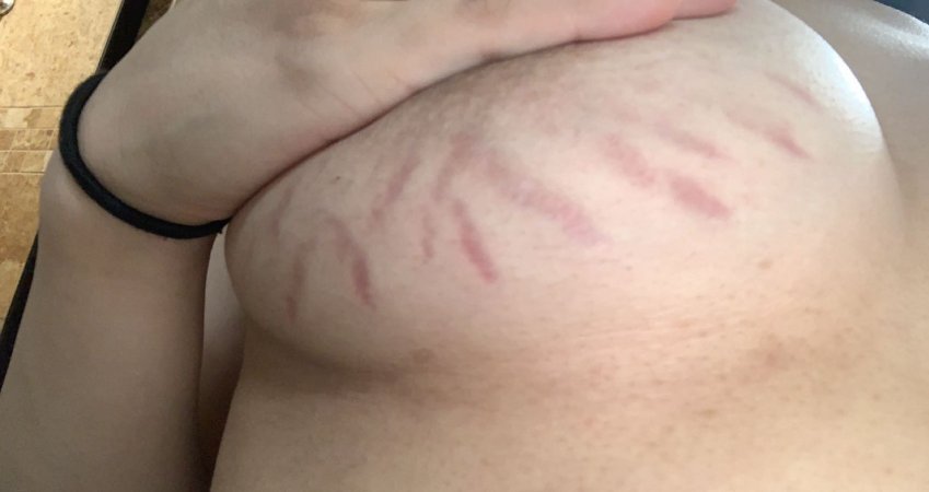 dilek suna share tits with stretch marks photos