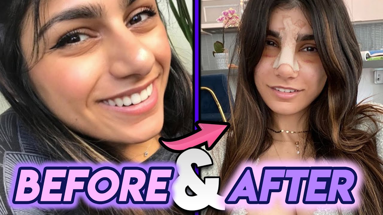 christie gulley recommends mia khalifa before and after pic