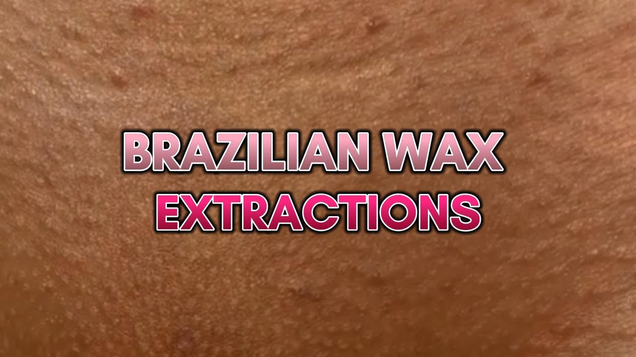 Best of Brazilian wax pictures photos