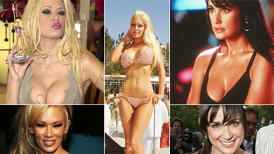 debbie rohloff recommends 4000 Cc Breast Implants