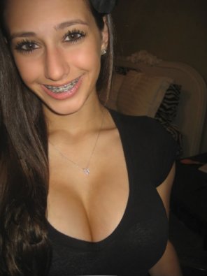 Best of Girls with braces naked