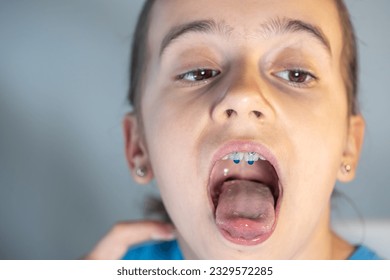 mouth open tongue out pics