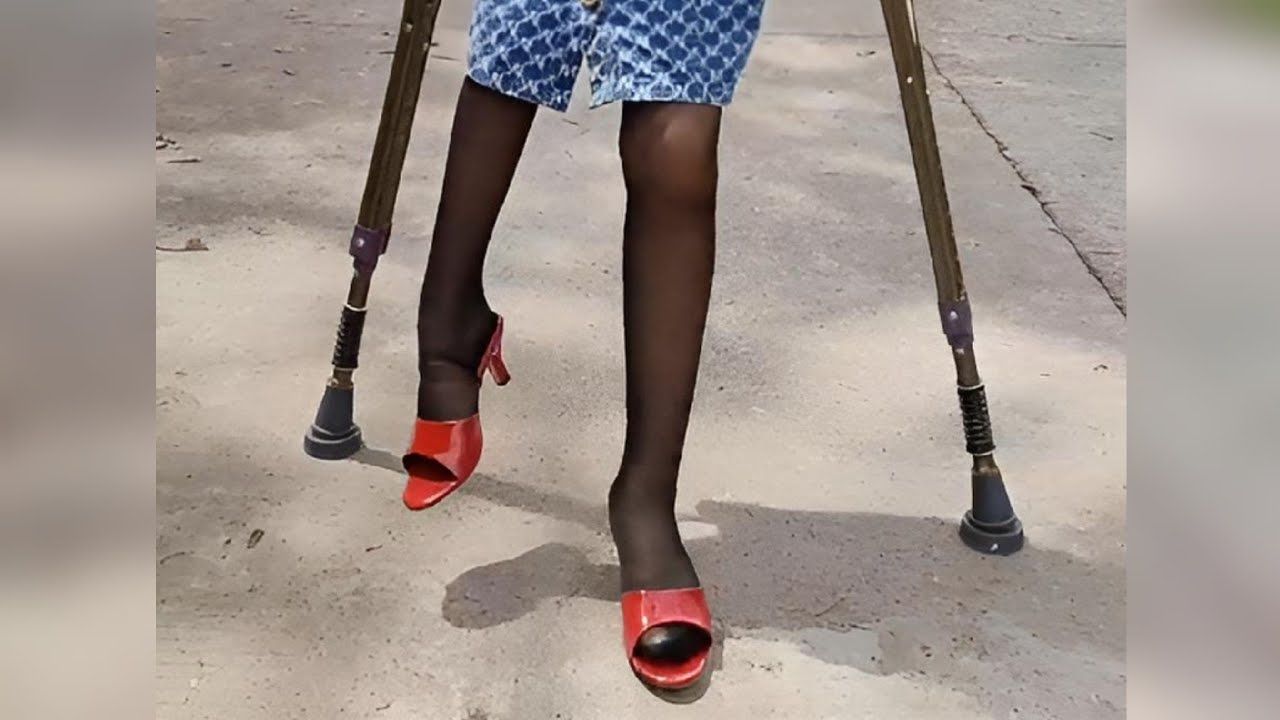 charlie sebesta recommends polio short leg women pic