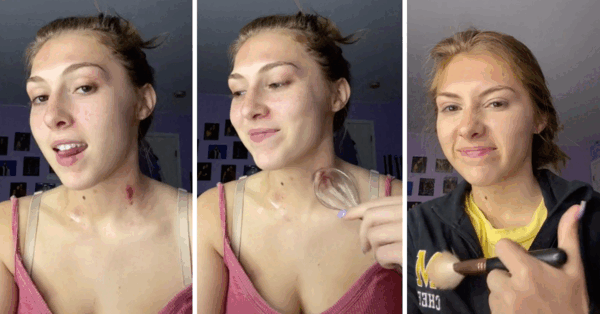 donnie troutman share hickeys on tits photos