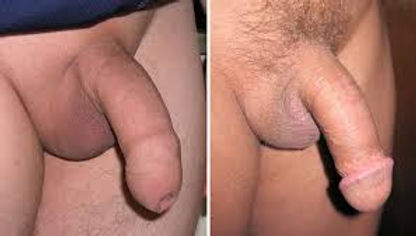 ansar rahim recommends photos of uncut penis pic