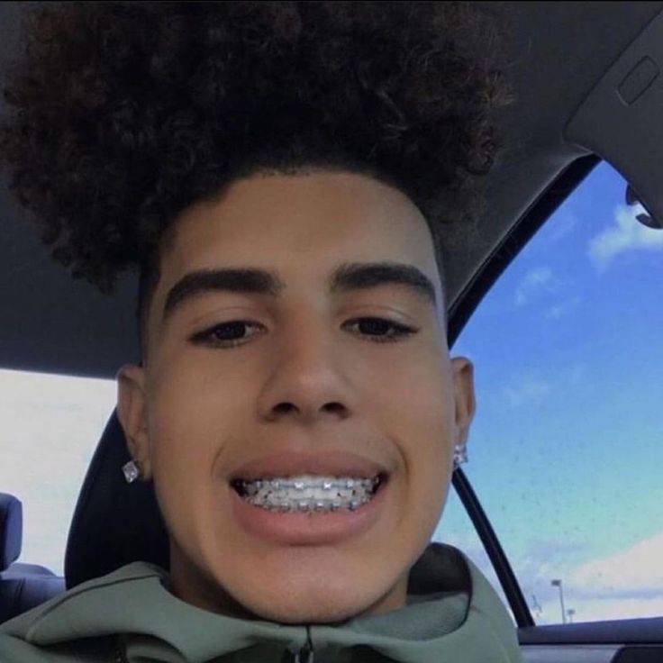 arben haziri recommends Cute Braces Colors For Light Skins