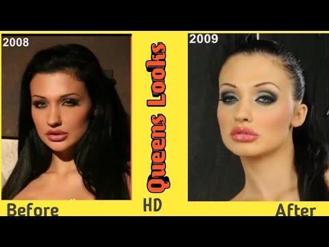 barbara spedden recommends Aletta Ocean Plastic Surgery