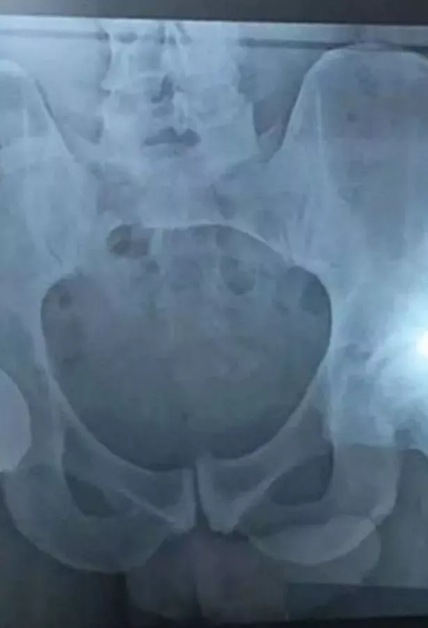 Best of Xray with big penis