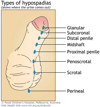 Best of Which hole do i put my penis in