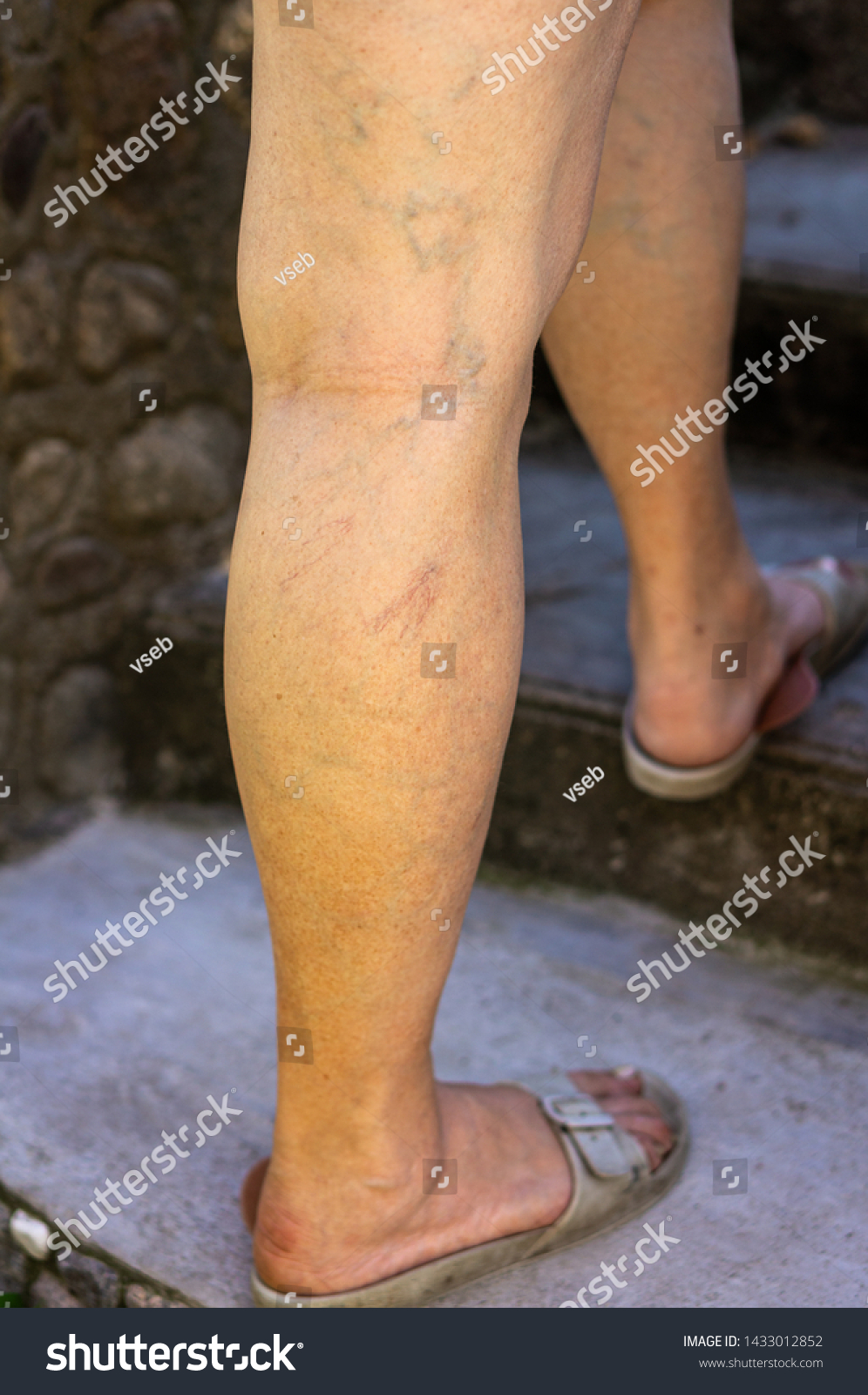 carla ferdinand recommends mature legs pics pic