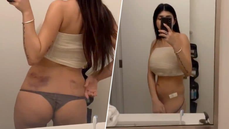 aristotle bongo add mia khalifa before and after photo