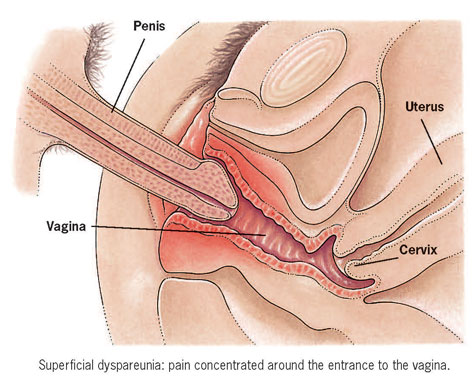 Penis Into Vagina Pictures iwoos ryino