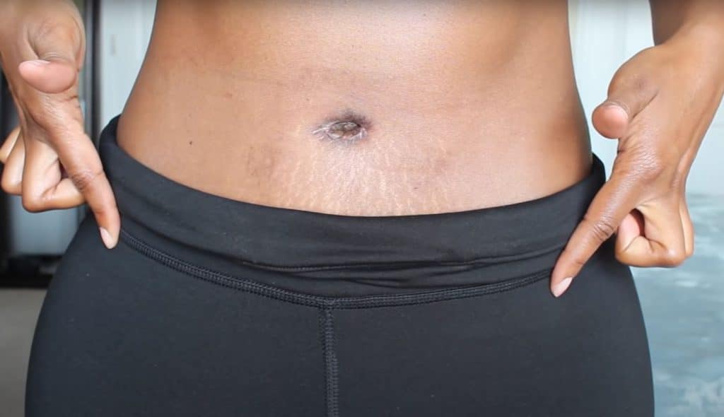 anandan sam add photo black women belly button