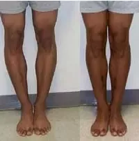 Best of Gap between legs pictures