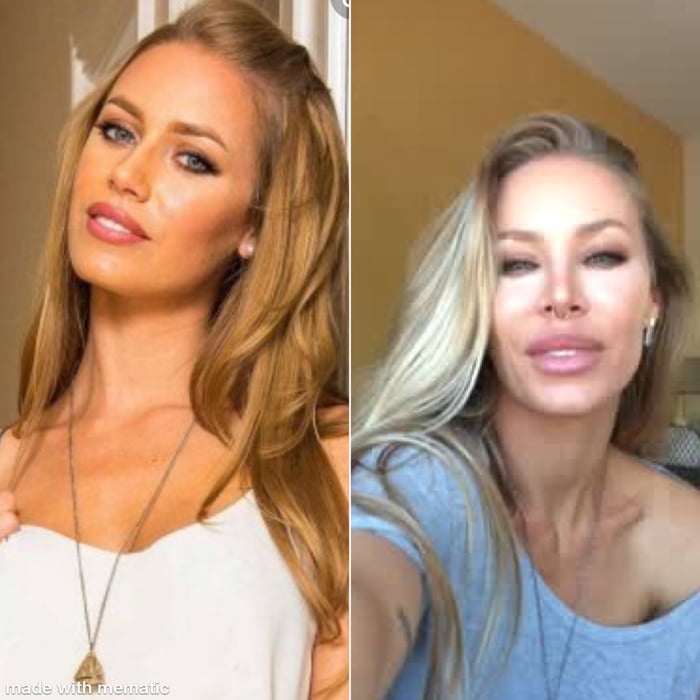 nicole aniston before after