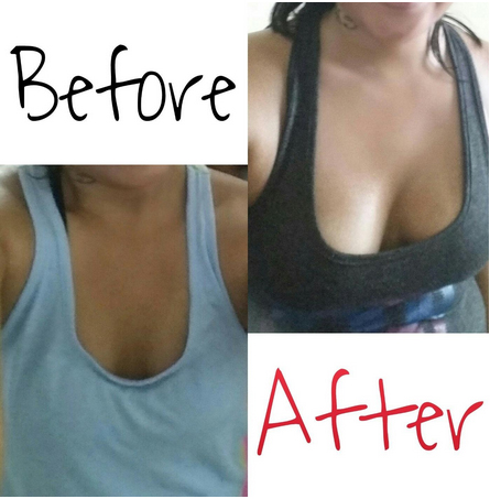 Best of Areola before and after pregnancy pictures