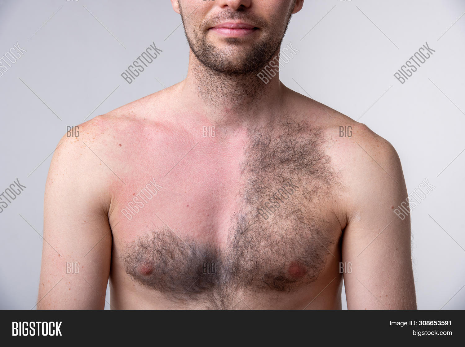 corey pettis recommends black man chest hair pic