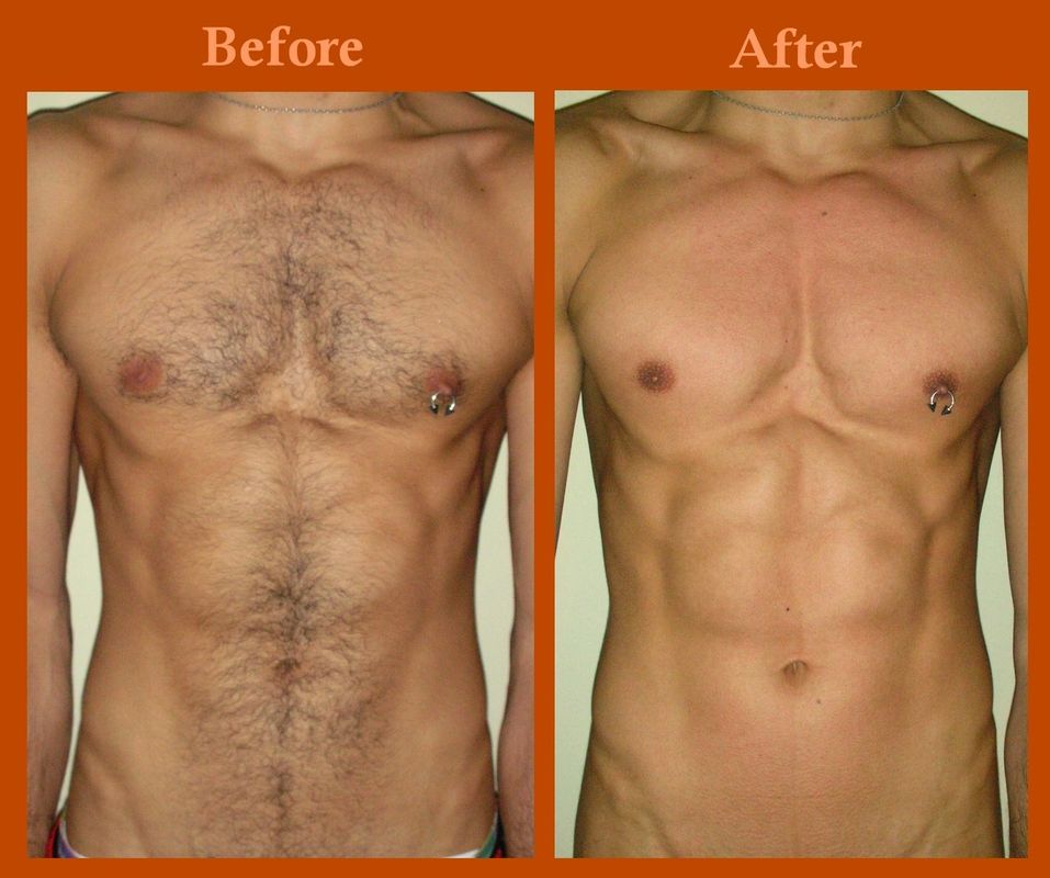 Brazilian Wax Pictures Before And After Male funny xxx