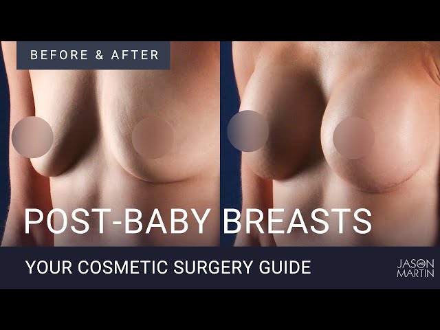 breasts pics before and after pregnancy