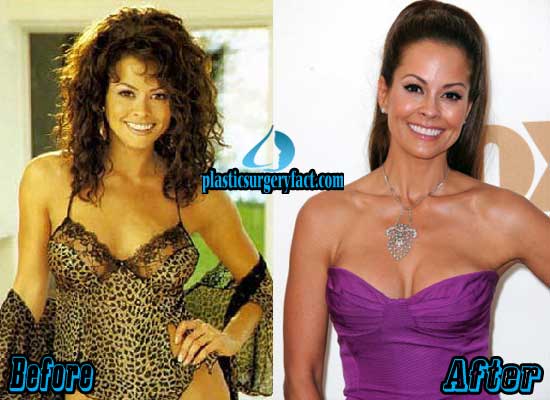 brooke burke boob job