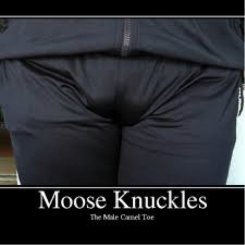 doug litchen add photo moose knuckle vs camel toe