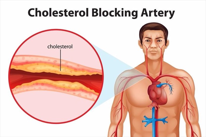 chris leising recommends womans clit on steroids pic