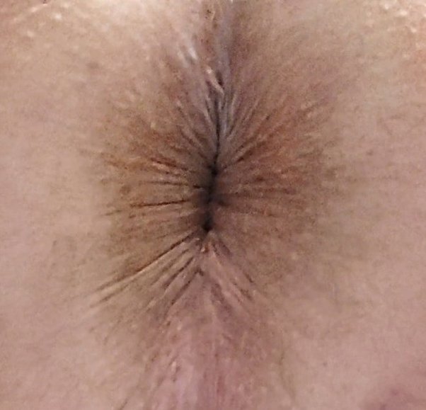 butt hole close up