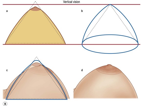 Cone Shaped Tits rains porn