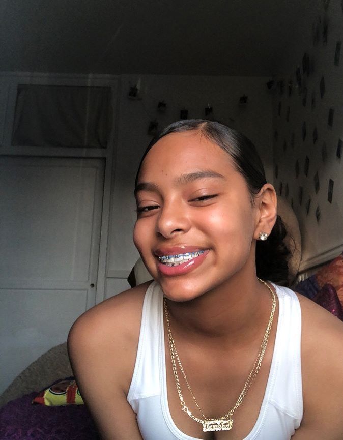 cherrine hendrix recommends Cute Braces Colors For Light Skins