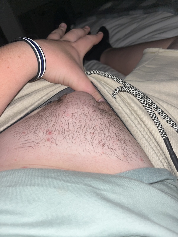 ardi ardana recommends teen pubic hair pics pic