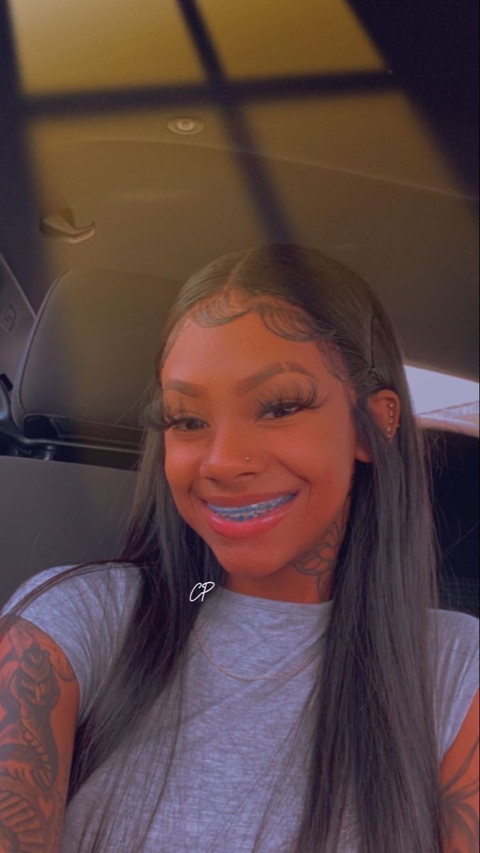 beverly goff add cute braces colors for light skins photo