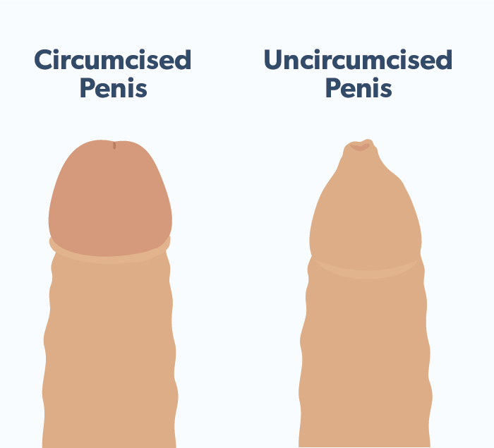 pics of uncut penis