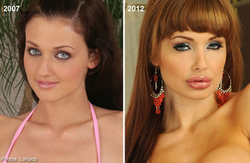 Best of Aletta ocean plastic surgery