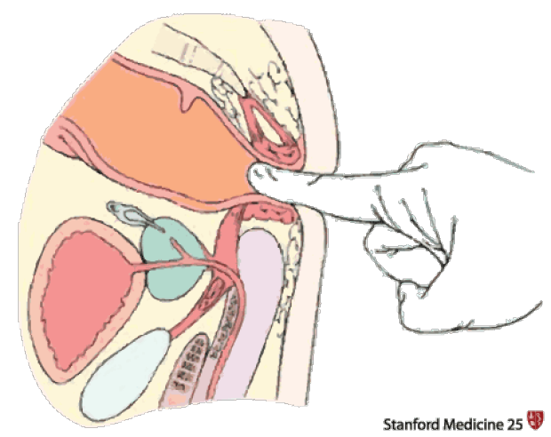 chesney wheeler recommends erotic rectal exam stories pic