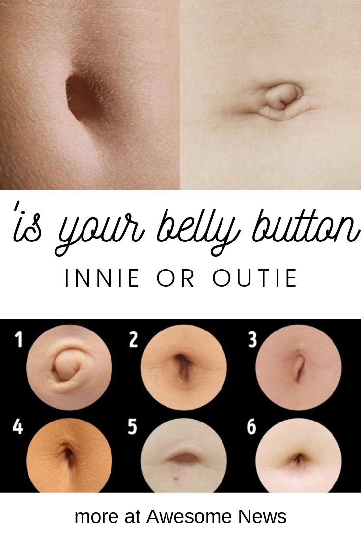 Best of Images of outie belly buttons