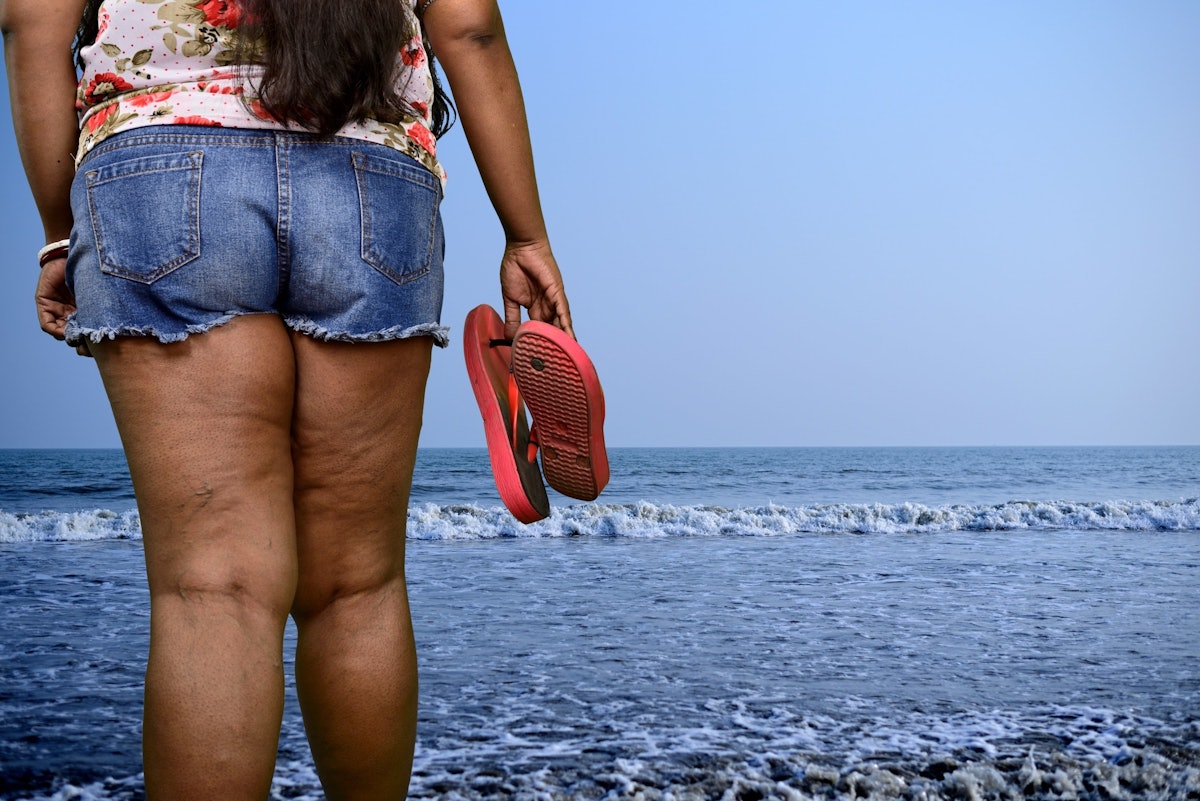 chereen brown add fat woman in shorts photo
