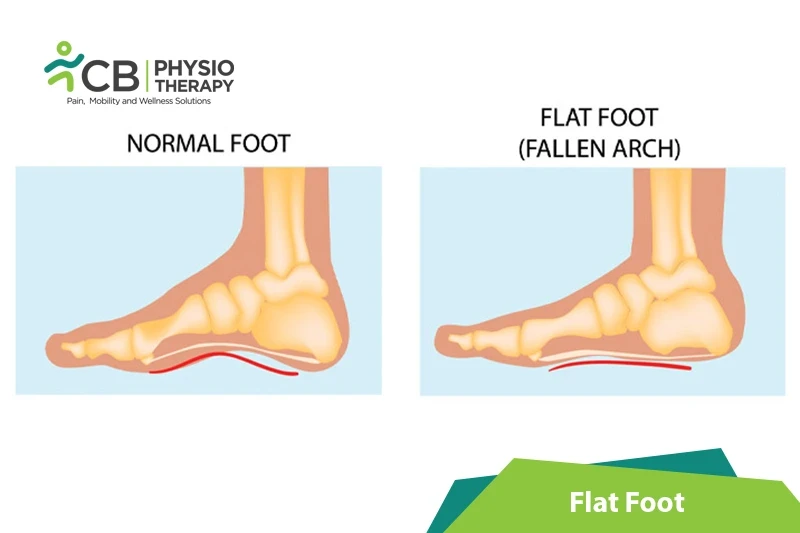 dan rowley recommends Foot Feta Ish Definition