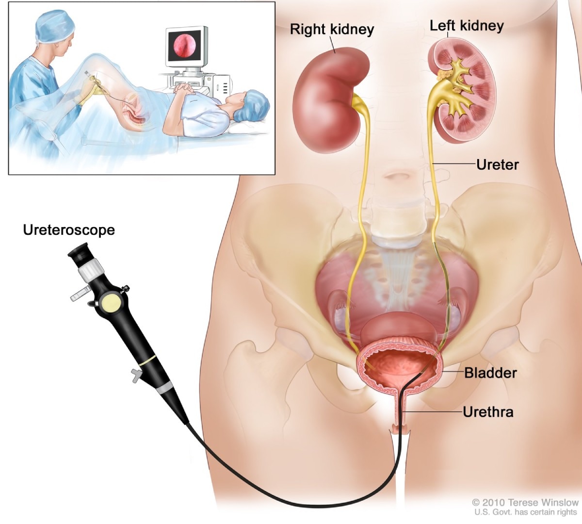 bradley best recommends injecting air into urethra pic