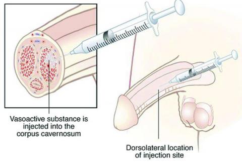 bryan hales share injecting air into urethra photos