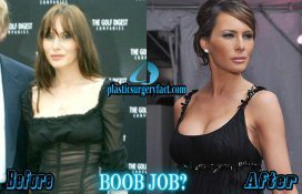 anthony patricola recommends Melania Trump Tits