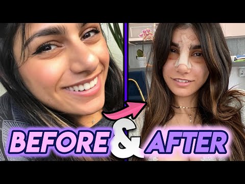 brady daniel share mia khalifa before and after photos