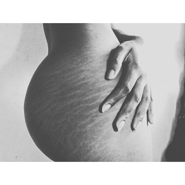 divyesh nandola recommends sexy stretch marks tumblr pic
