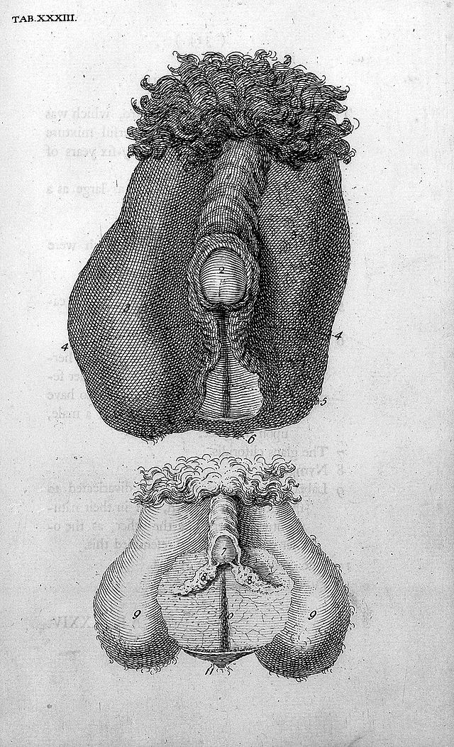 Show Me Pictures Of Morphodites dildo pictures