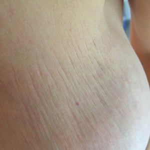 charlie saucier recommends tits with stretch marks pic